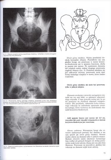 ABC Radiologii Stanów Nagłych - D.Nicholson - 73.jpg